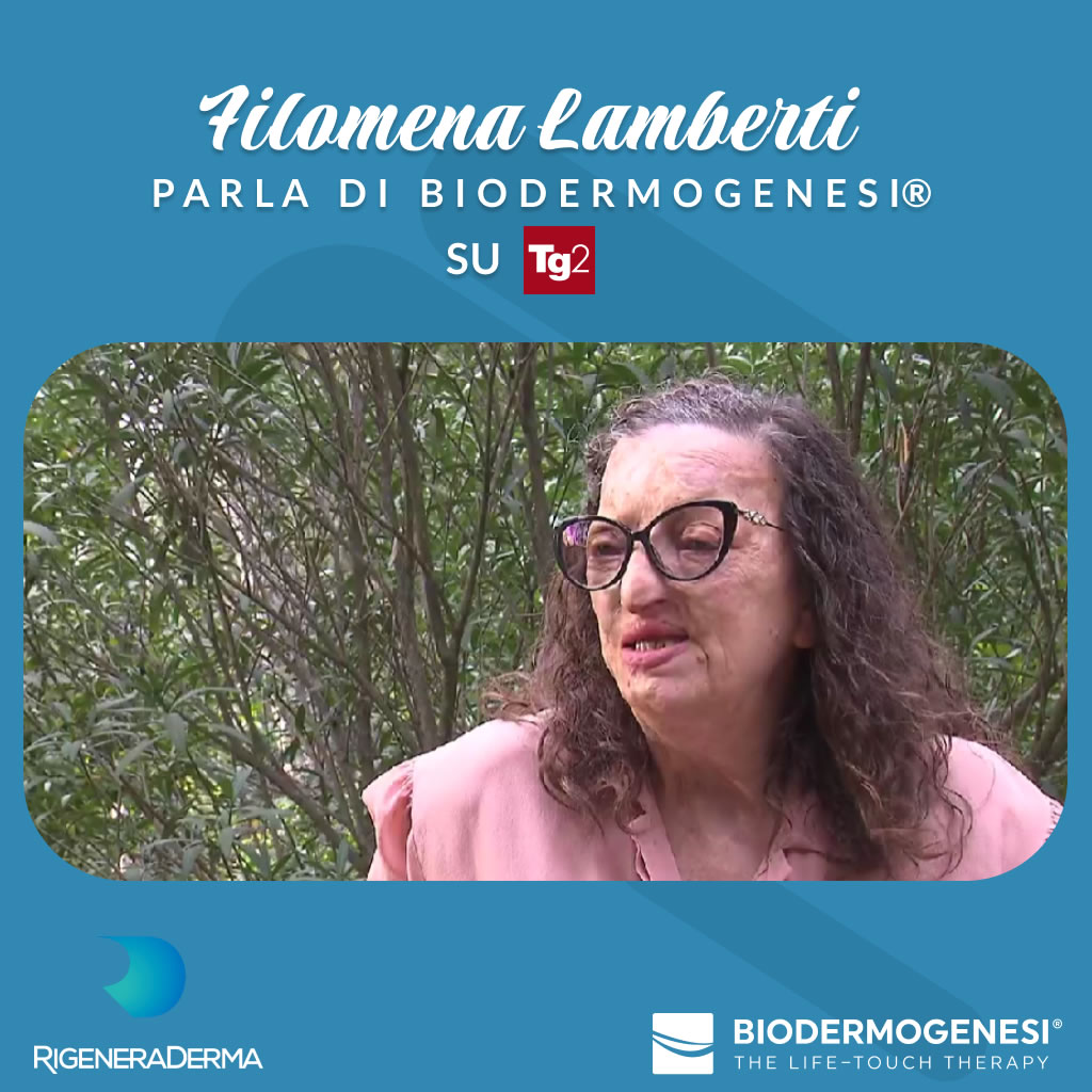 FILOMENA LAMBERTI PARLA DI BIODERMOGENESI® SU TG2